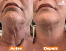 HoneySkin® - Oléo Rejuvenescedor e Redutor de Papada (100% MEL PURO)