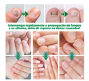 OilNail® - Sérum Reparador Rápido de Unhas (REPARAÇÃO EM 7 DIAS)