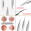 Pinças Super Skin - Kit Removedor de Cravos e Espinhas (3 Peças)