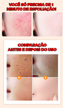 Gel Esfoliante e Clareador - ®OrangeBeauty (100% de Clareamento e Hidratação da Pele)