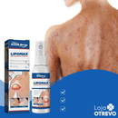 Spray Removedor de Nódulos - Lipomax®  ODER