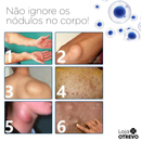 Spray Removedor de Nódulos - Lipomax®  (COMPRE 1 E LEVE 2) (APENAS HOJE)
