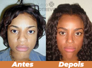 Sérum Definidor e Modelador de Nariz - DefRino®