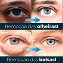 OpenEyes - Creme Reparador Rápido de Olhos (Elimina Rugas, Bolsas e Olheiras)