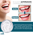 Nature Smile® - Facetas Dentárias Removíveis (COMPRE 1 PAR E LEVE OUTRO)