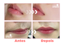 Spray Identificador de Pelos - FastDepil® (Depilação Rápida e 100% Eficiente)