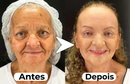 Máscara de Efeito Peeling Natural Puro Colágeno - NewFace®