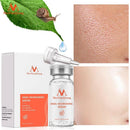 Redutor de Poros, Manchas Baba de Caracol - ®Nailmax