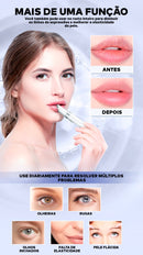 Caneta Massageadora Iônica Anti Rugas e Olheiras ®YoungBeutry (PELE 100% MAIS JOVEM)