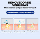Removedor de Verrugas Olho de Peixe ®ClearCream
