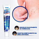 Removedor de Verrugas Olho de Peixe ®ClearCream
