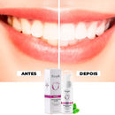 Super Clareador Dental e Removedor de Manchas -®RtopR