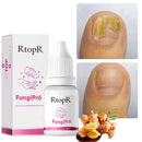 FungiPró RtopR® 3 em 1 (Reparador, Restaurador e Fortalecedor de Unhas)