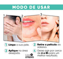 Adesivos Hidrocoloide Secadores e Removedores de Espinhas - AcneControl®
