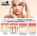 Adesivos Hidrocoloide Secadores e Removedores de Espinhas - AcneControl®